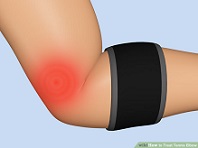 بریس آرنج تنیس بازان , ارنج تنیس بازان , tennis elbow brace